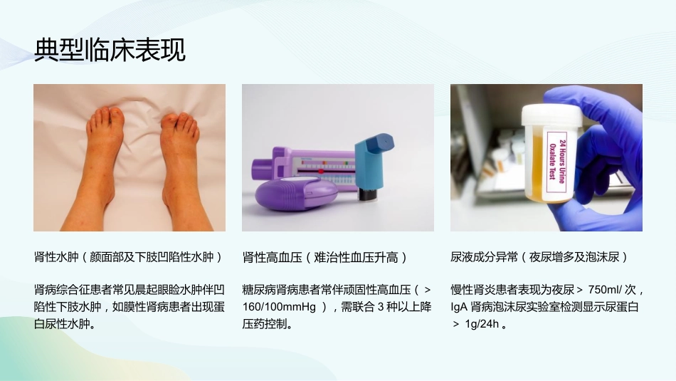 慢性肾脏病和透析课件_第13页