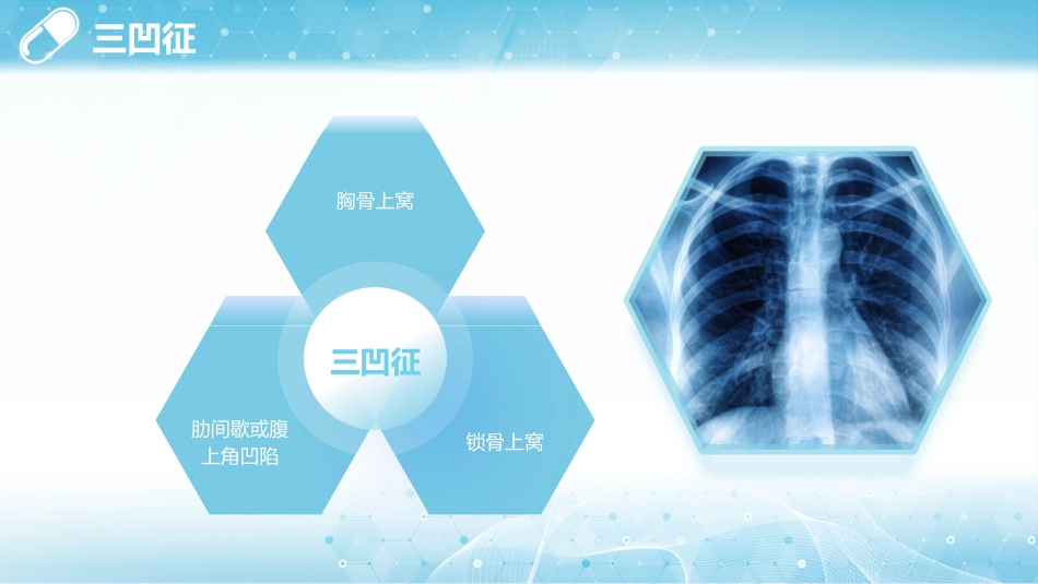 呼吸困难的护理1_第10页