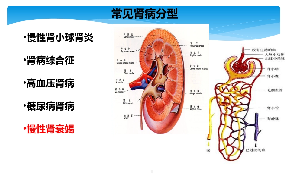尿毒症患者科学饮食ppt课件_第4页