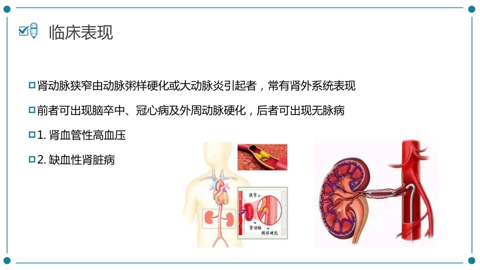 肾动脉狭窄患者的护理_第11页