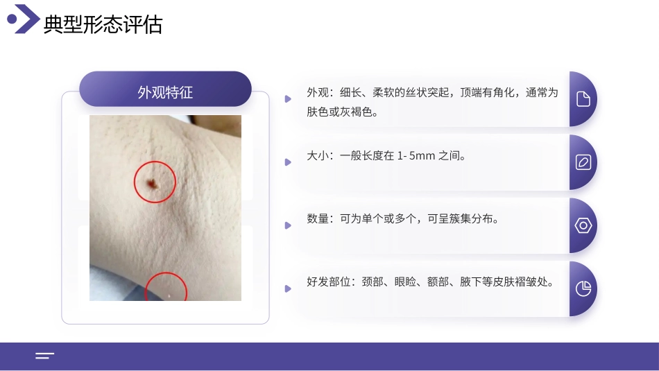 丝状疣护理查房带参考文献_第14页