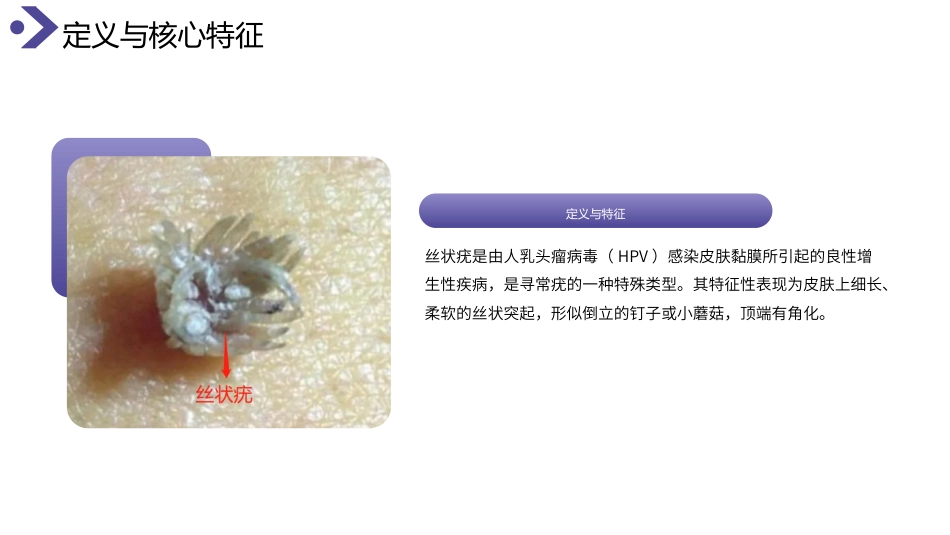 丝状疣护理查房带参考文献_第4页
