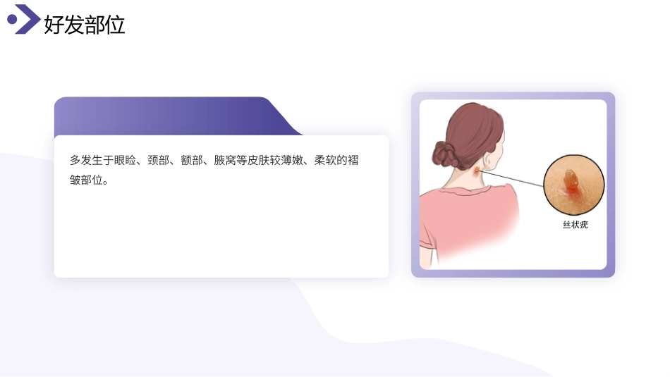 丝状疣护理查房带参考文献_第5页