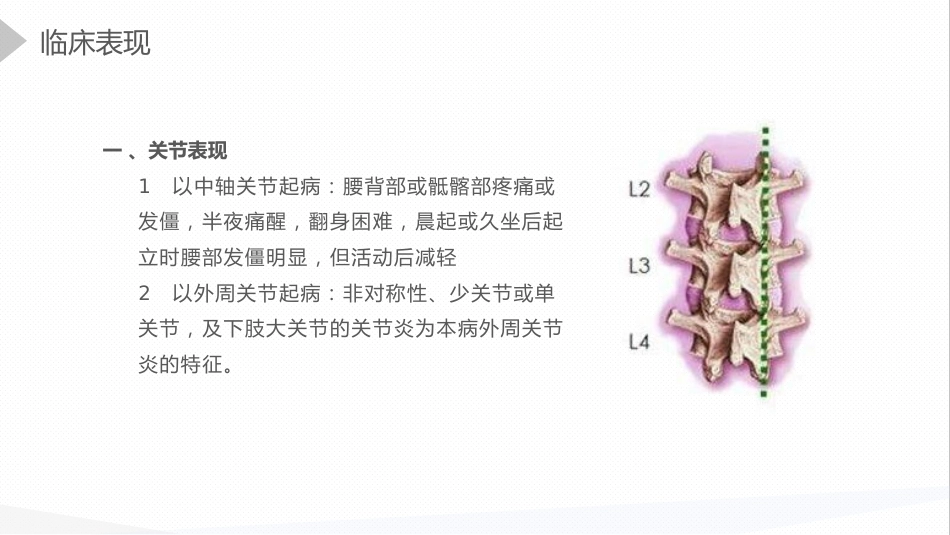 内科护理：强直性脊柱炎的护理查房_第10页