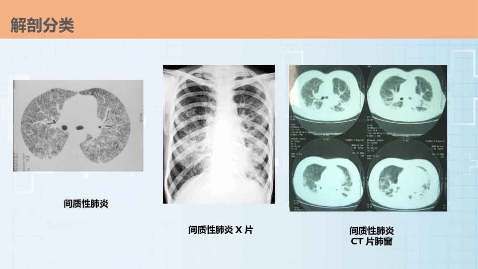 肺部感染的护理查房PPT课件_第14页