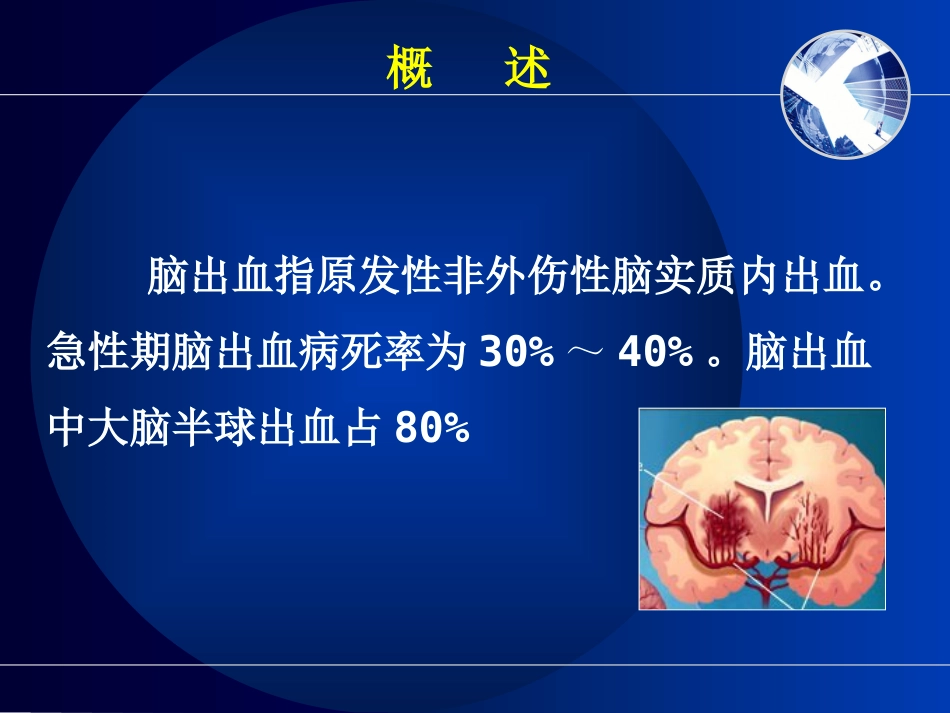 脑出血的护理_第4页