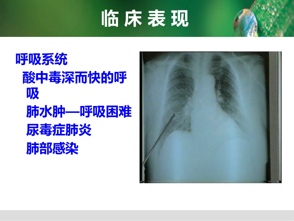 尿毒症病人的护理_第10页