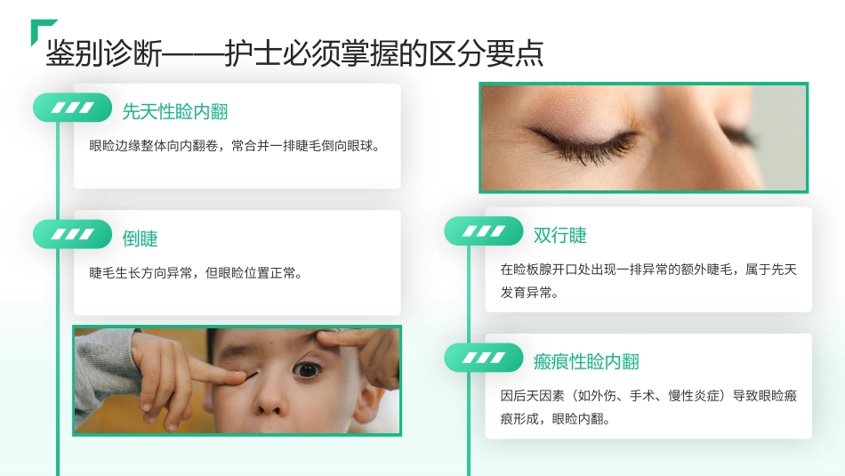 儿童睑内翻倒睫护理查房带参考文献_第5页