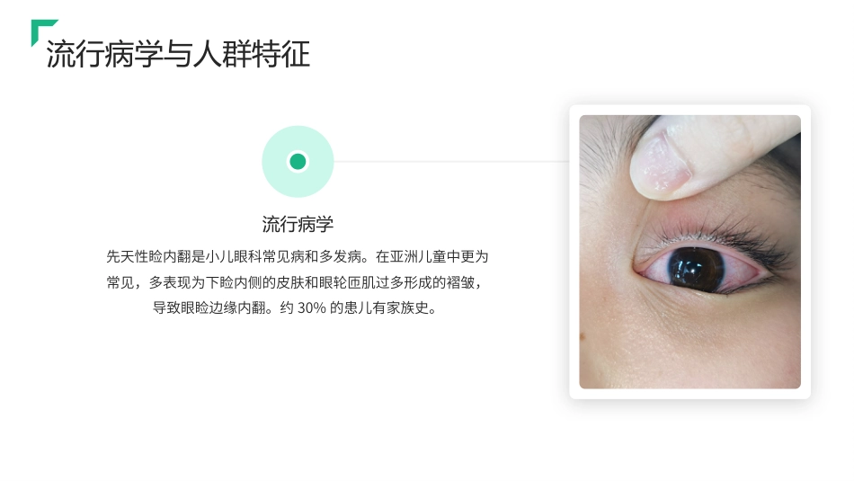 儿童睑内翻倒睫护理查房带参考文献_第6页
