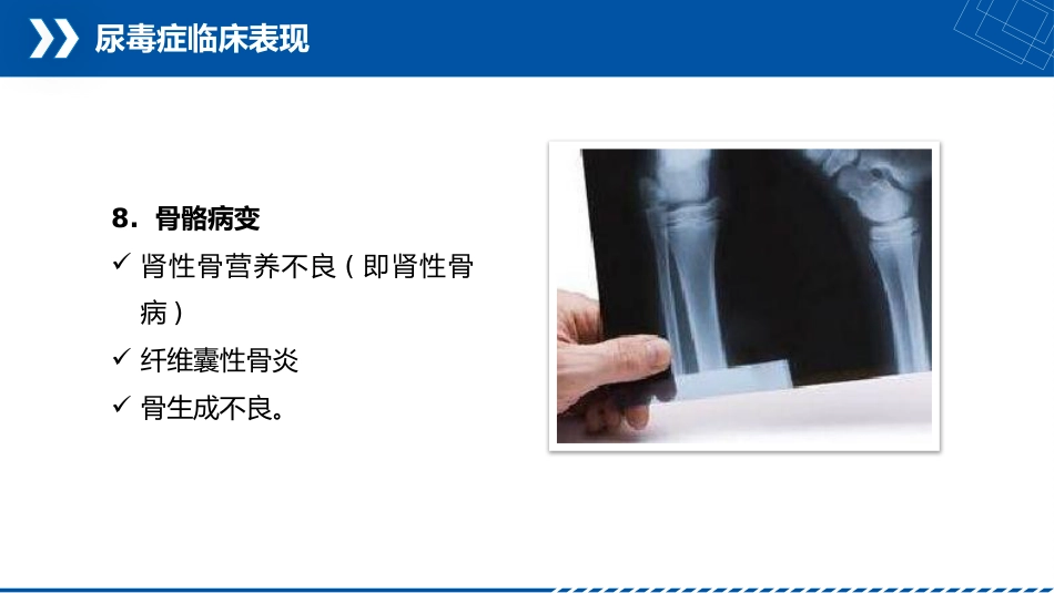 尿毒症患者护理查房_第10页