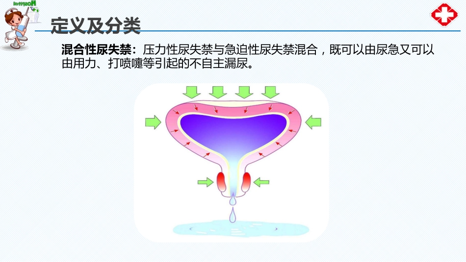 尿失禁患者的评估与护理_第10页