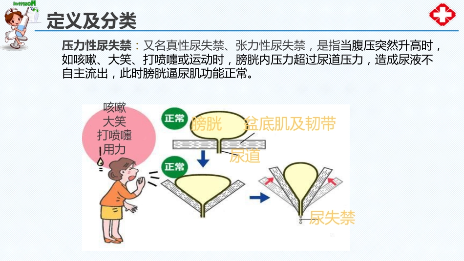 尿失禁患者的评估与护理_第8页