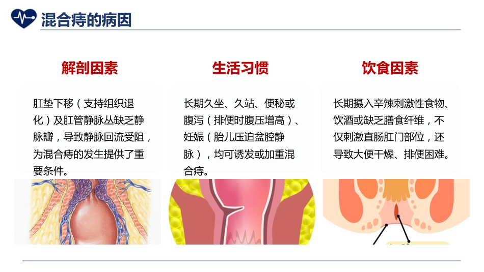 混合痔护理_第5页