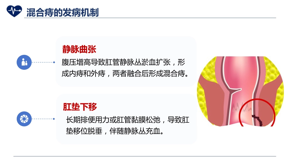 混合痔护理_第6页