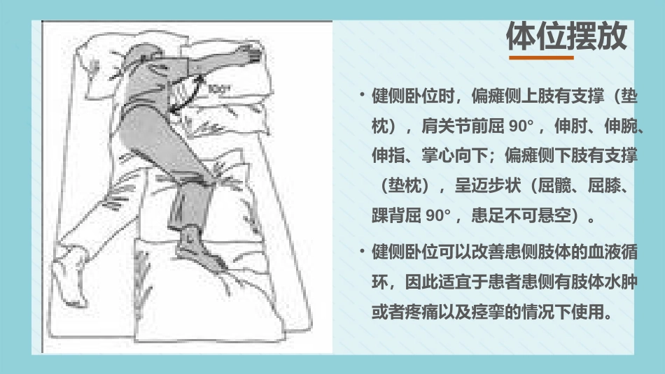 内科护理：脑梗死病人的护理_第15页