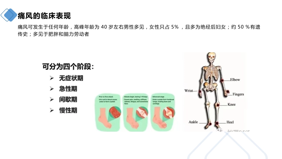 痛风患者的护理_第9页