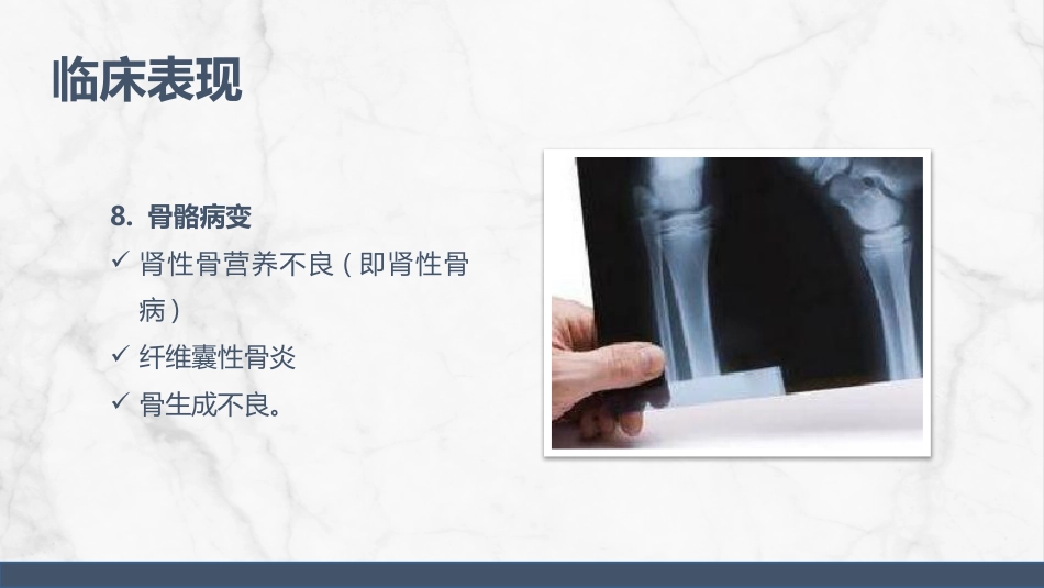 尿毒症护理查房_第12页
