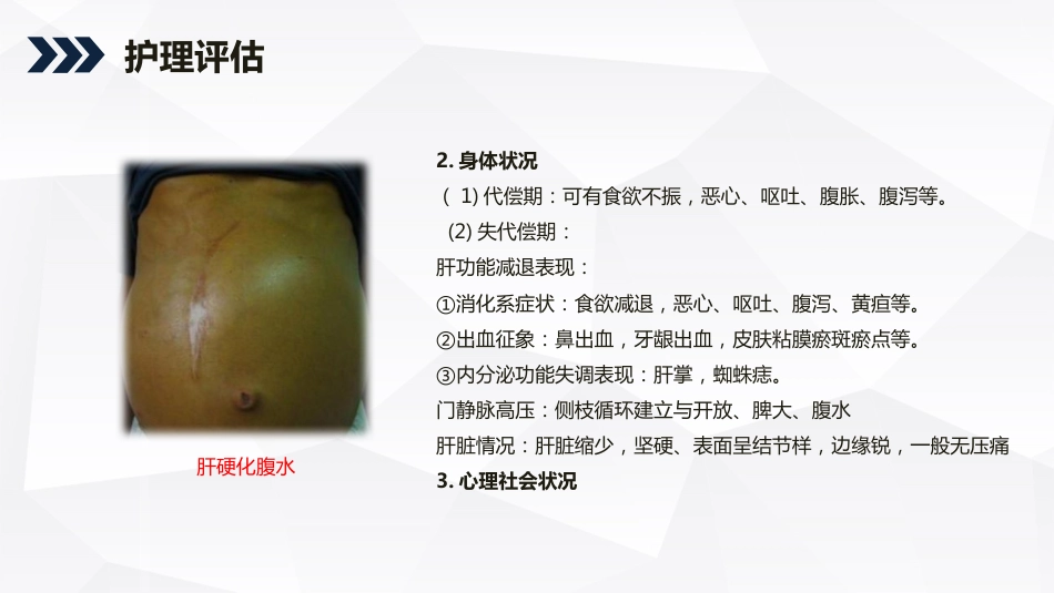内科护理：酒精性肝硬化护理教学查房_第13页