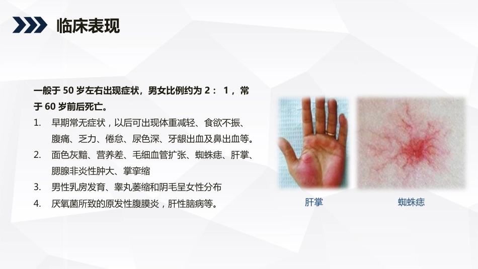 内科护理：酒精性肝硬化护理教学查房_第9页