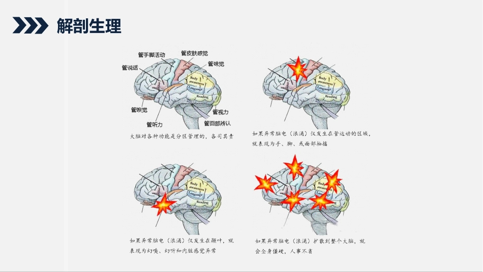 内科护理：继发性癫痫患者的护理查房_第5页