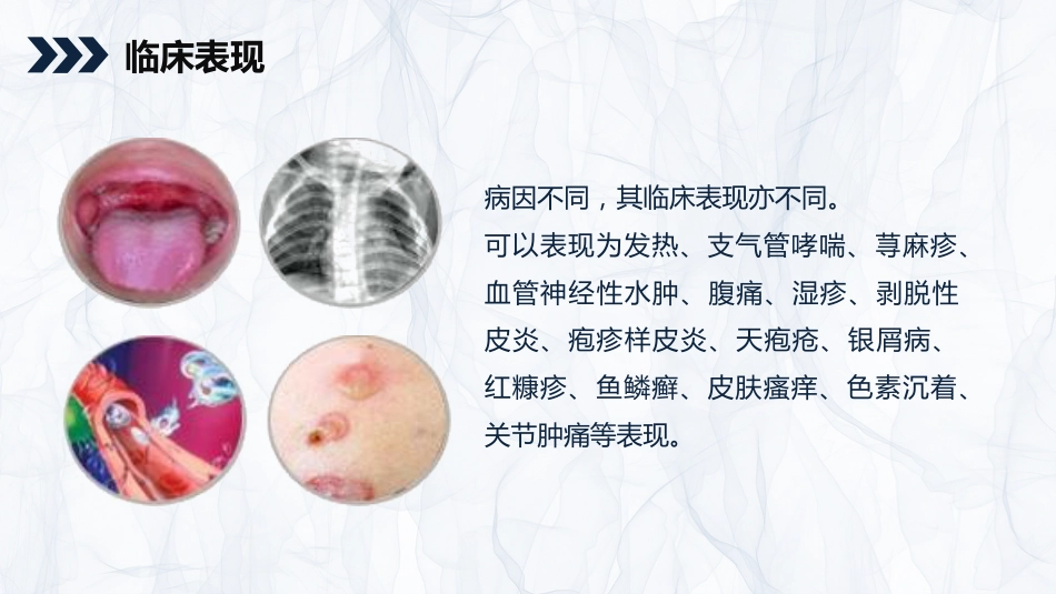 内科护理：嗜酸细胞增多症的护理查房知识_第11页