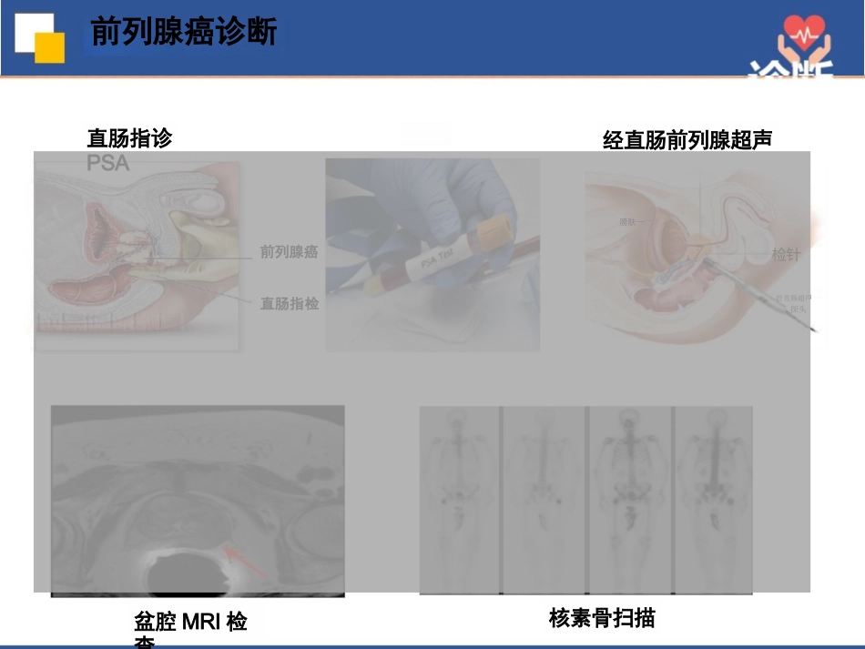 前列腺癌根治术护理查房_第10页
