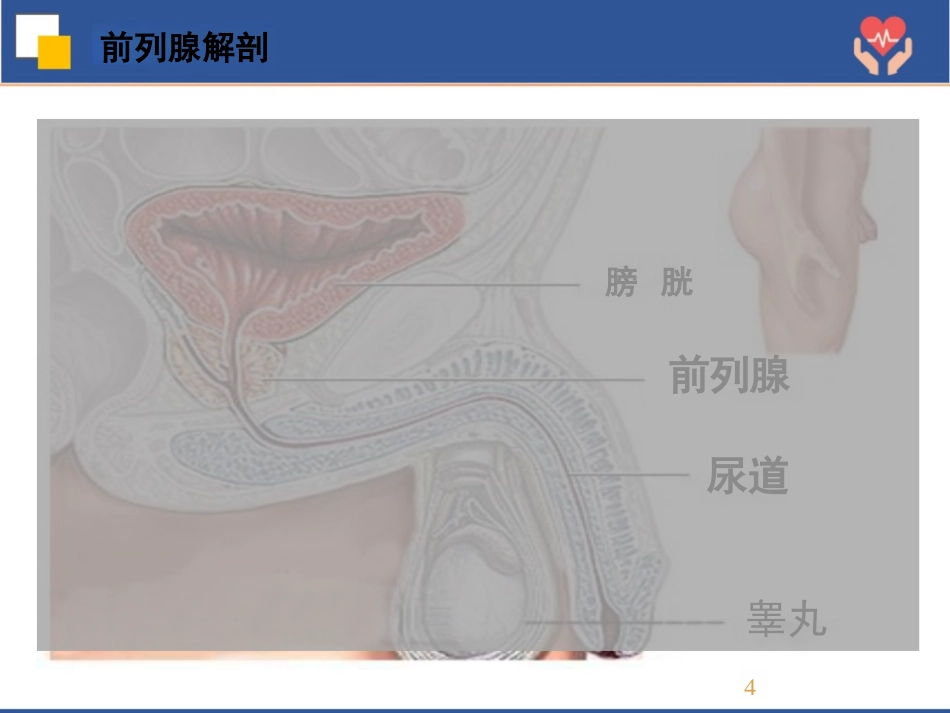 前列腺癌根治术护理查房_第4页