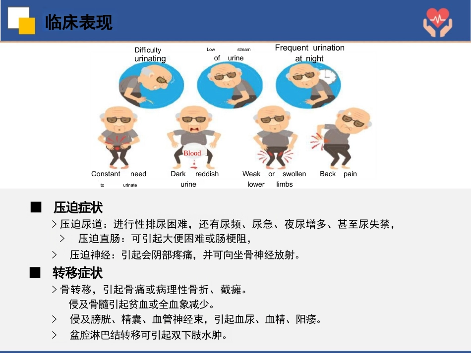 前列腺癌根治术护理查房_第9页