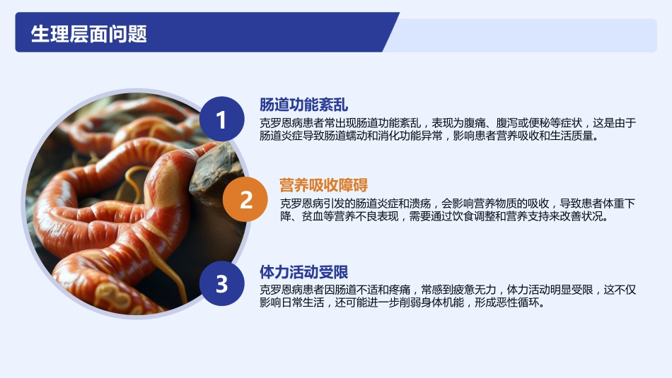克罗恩病护理查房_第14页