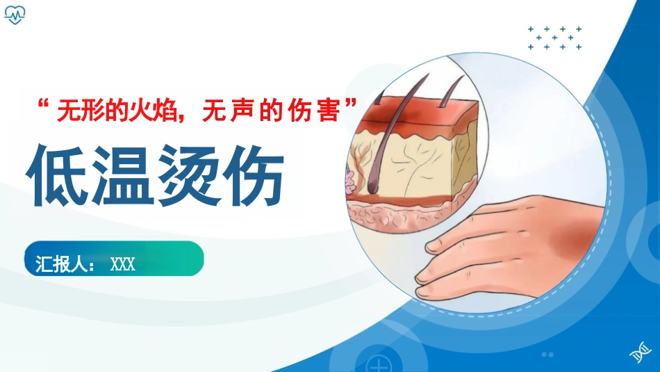 低温烫伤_第1页