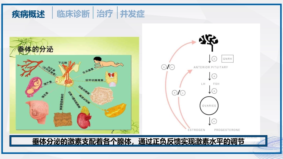 垂体瘤的治疗和护理_第11页