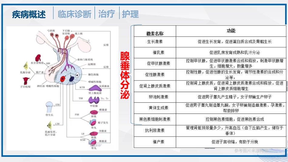 垂体瘤的治疗和护理_第12页