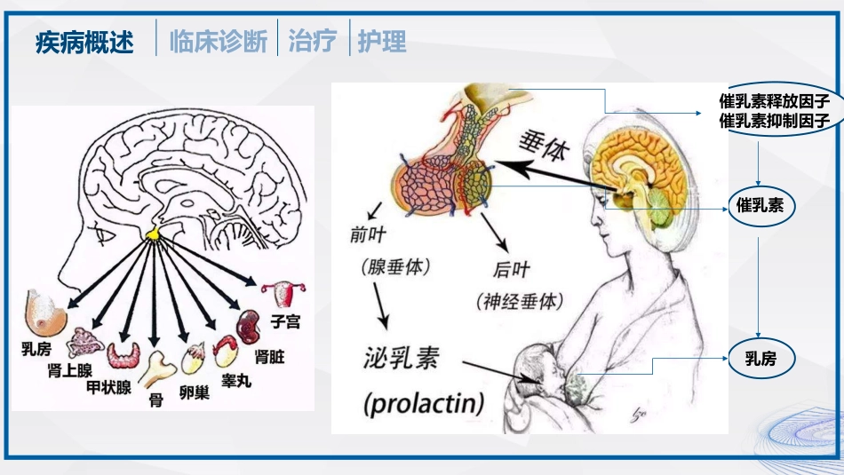 垂体瘤的治疗和护理_第13页