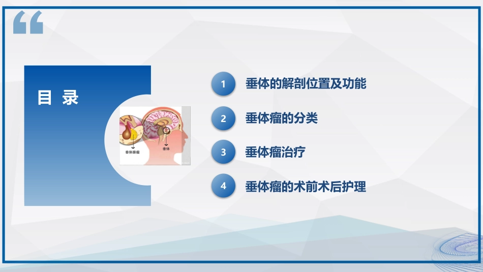 垂体瘤的治疗和护理_第2页