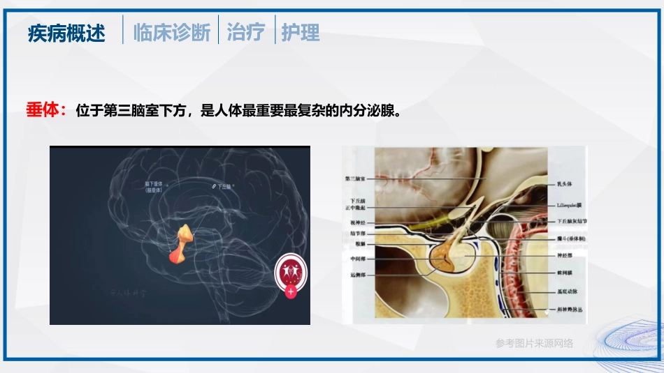 垂体瘤的治疗和护理_第5页