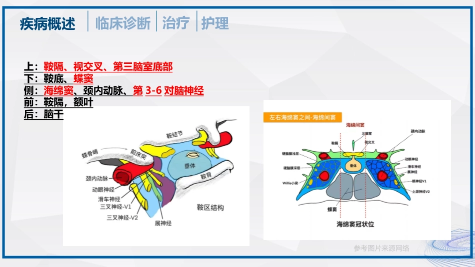 垂体瘤的治疗和护理_第6页