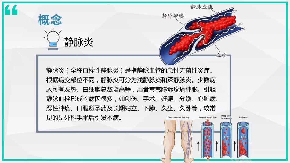 静脉炎的预防及处理_第4页