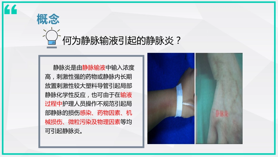 静脉炎的预防及处理_第5页