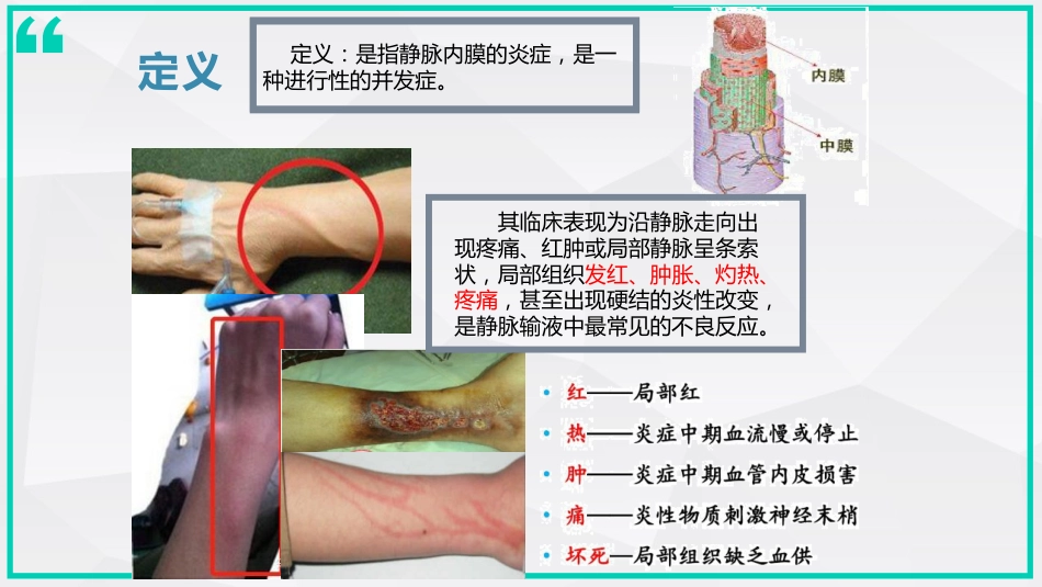 静脉炎的预防及处理_第6页