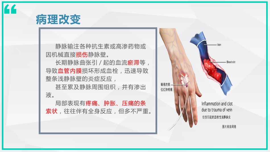 静脉炎的预防及处理_第7页