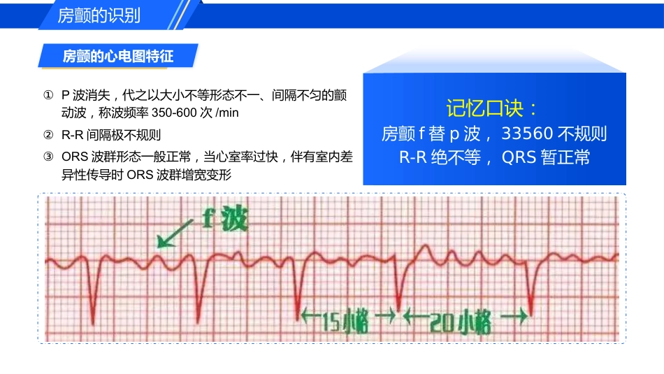 认识心房颤动_第13页