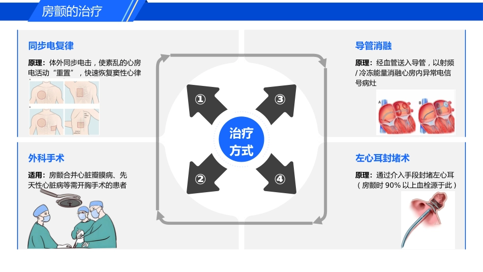 认识心房颤动_第14页