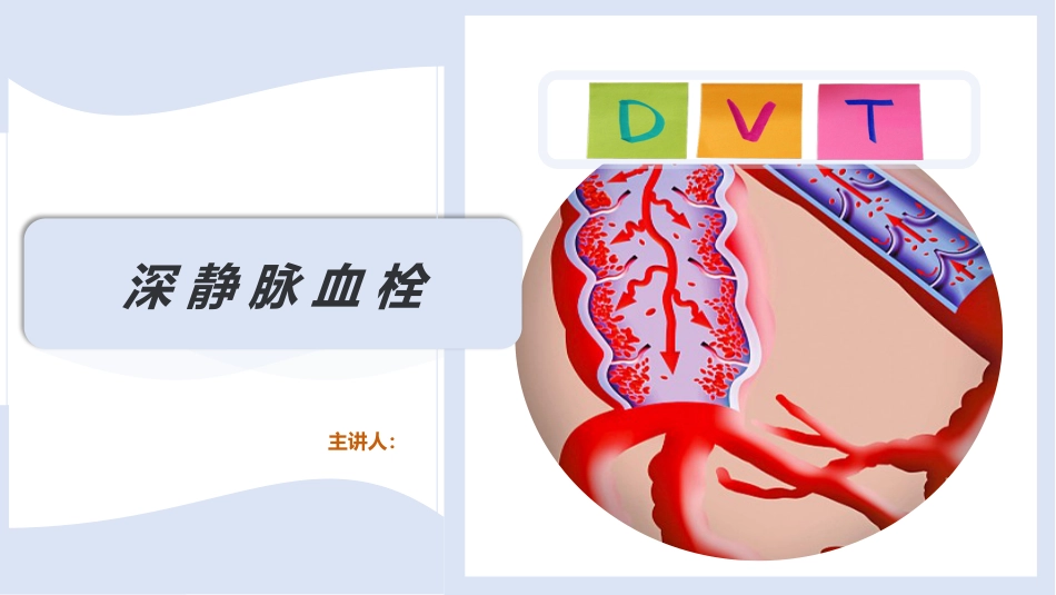 深静脉血栓_第1页