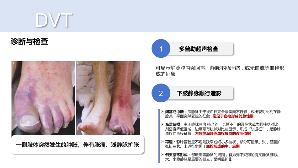 深静脉血栓_第10页
