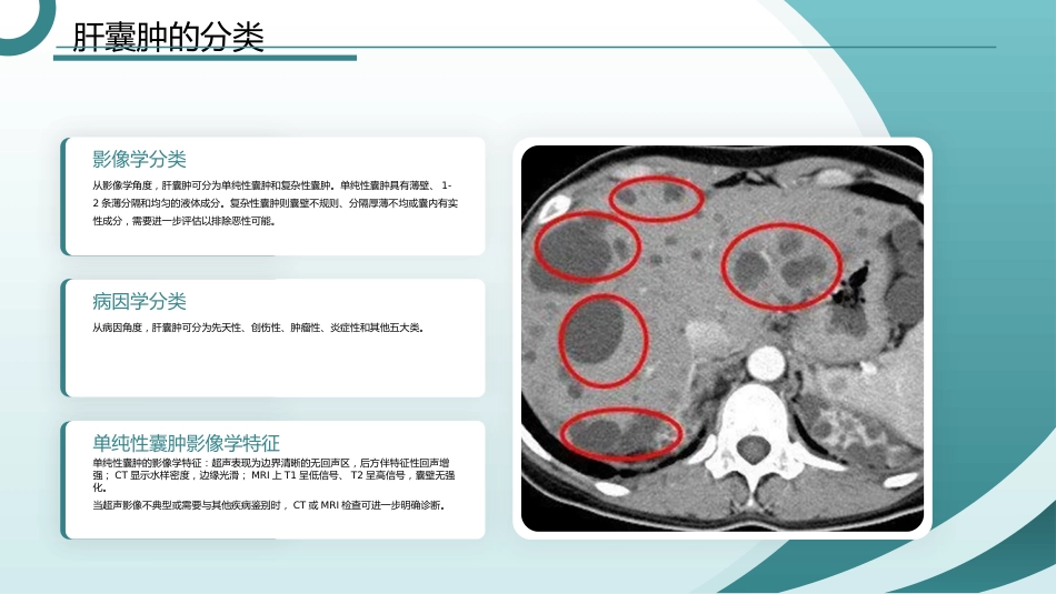 肝囊肿护理查房带参考文献_第6页