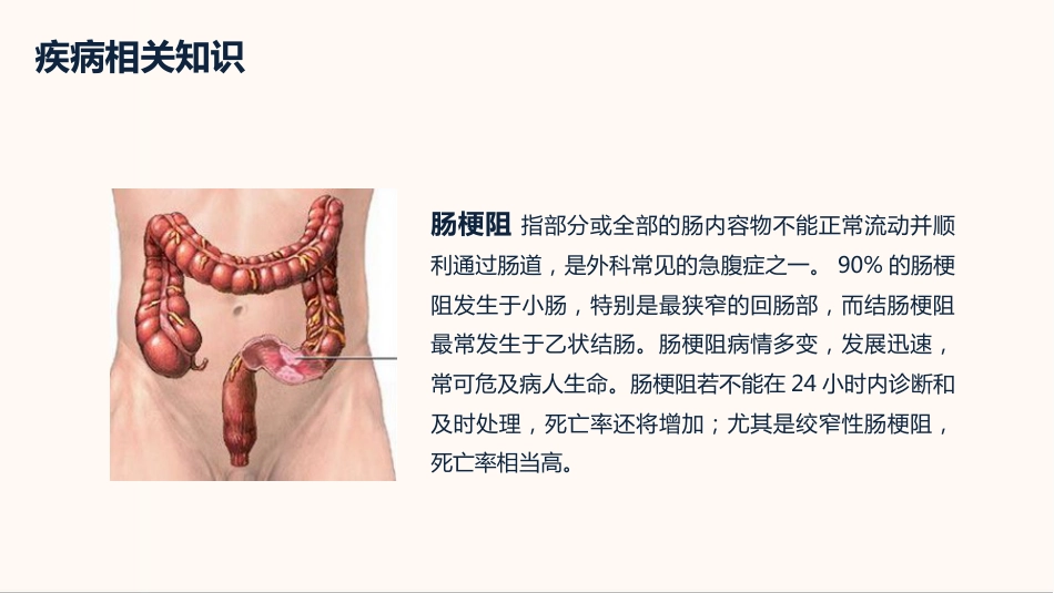 内科护理：肠梗阻护理查房_第4页