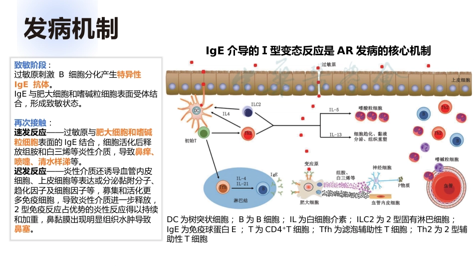 过敏性鼻炎_第10页