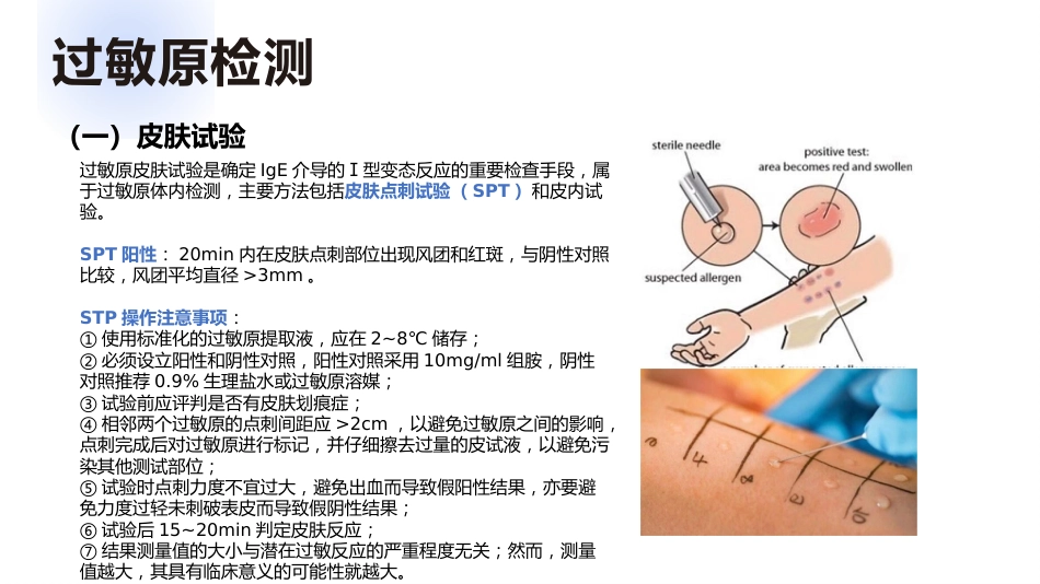 过敏性鼻炎_第14页