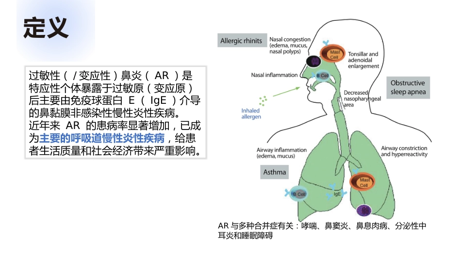 过敏性鼻炎_第4页