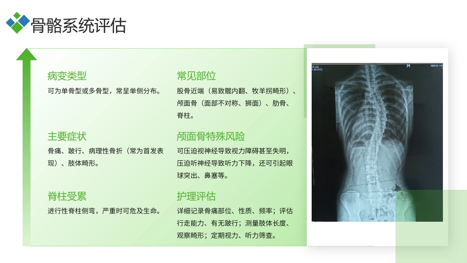 McCune-Albright综合征（MAS）护理查房带参考文献_第13页